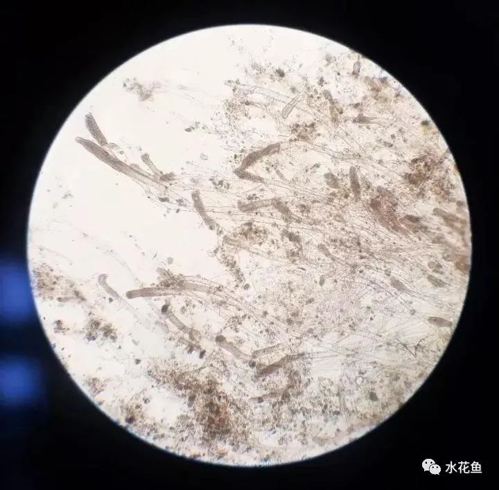 （显微镜下的水霉菌）.jpg